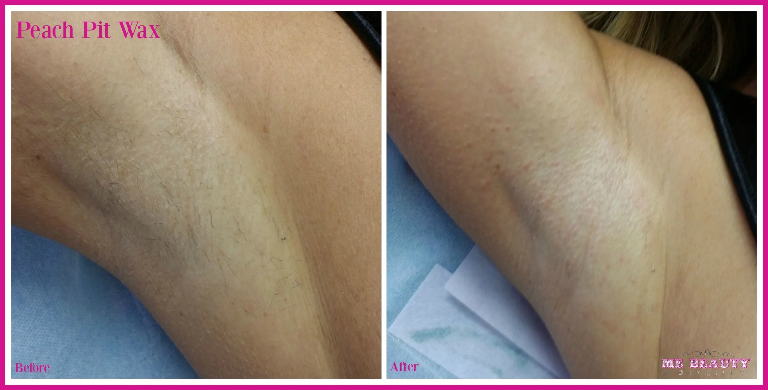 Brazilian Wax Pictures Before And After Female