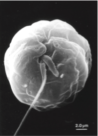 Scanning electron microscopy photo of a dinoflagellate isolated from Itasca State Park