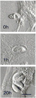 Microscopy of Toxoplasma invading a human cell.