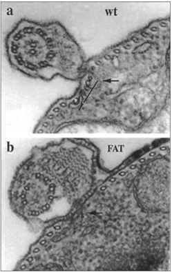 Cross section of trypanosome normal parasite (wt) and a mutant induced by tubulin RNA interference (FAT)