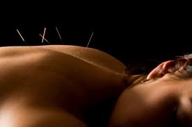 acupunture pic.jpg