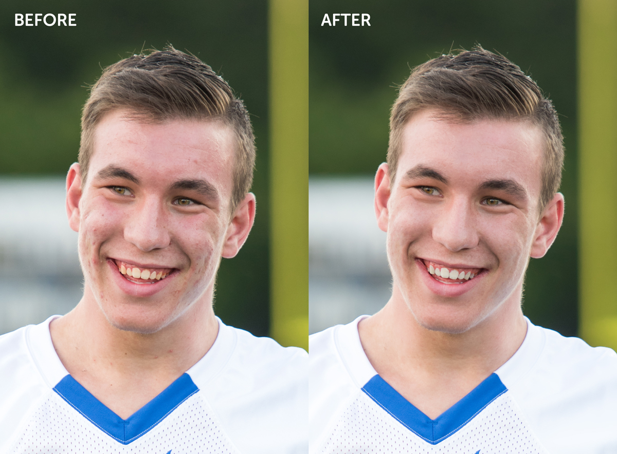before-after-zach2.jpg
