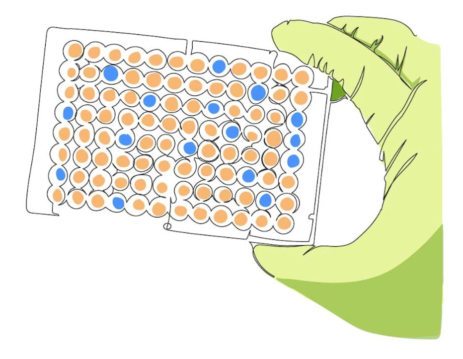A gloved hand holds the results of a medical test result.