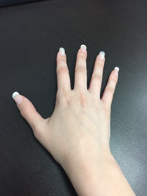 Interviewee's hand