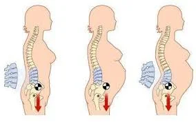 Effect of pregnancy on the mother's spine