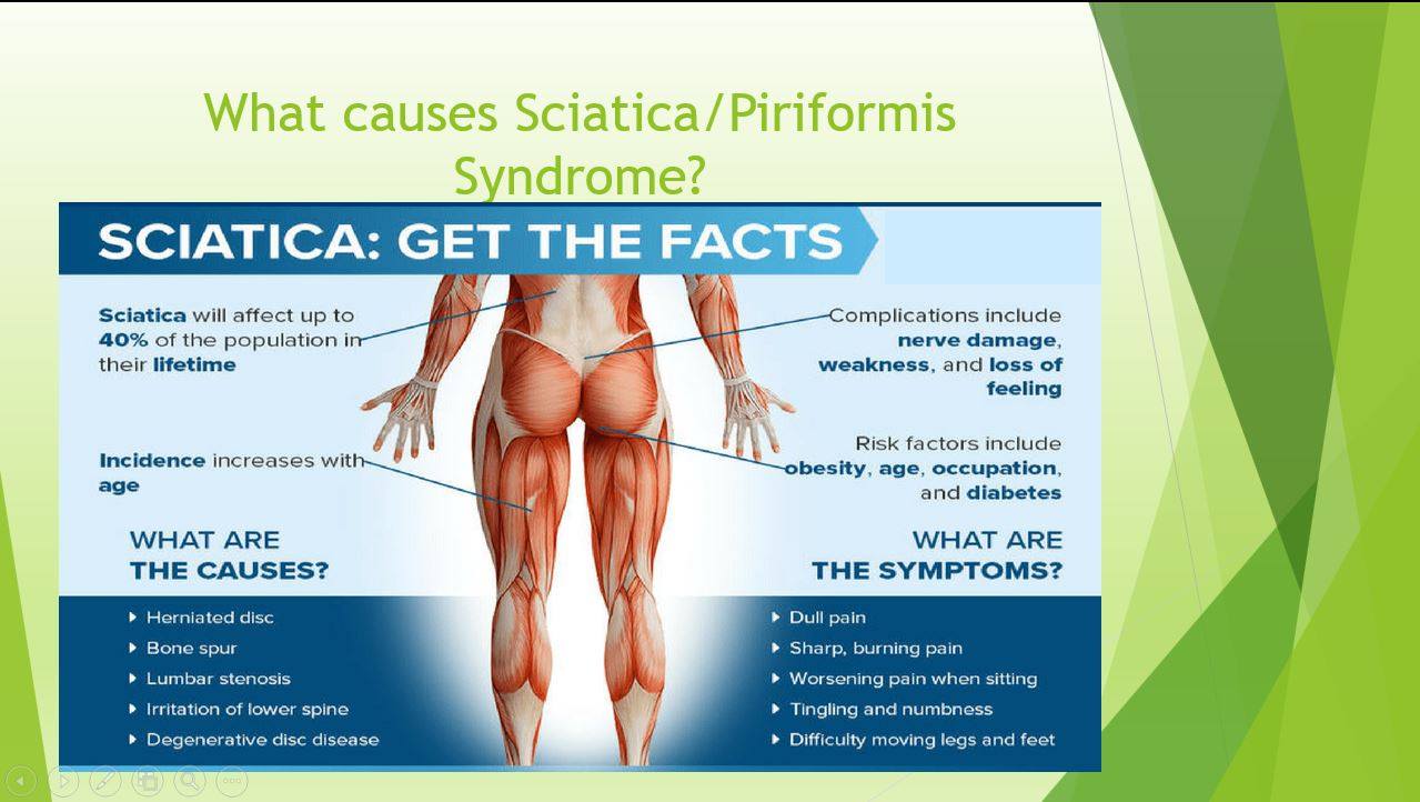 sciatica 3.jpg