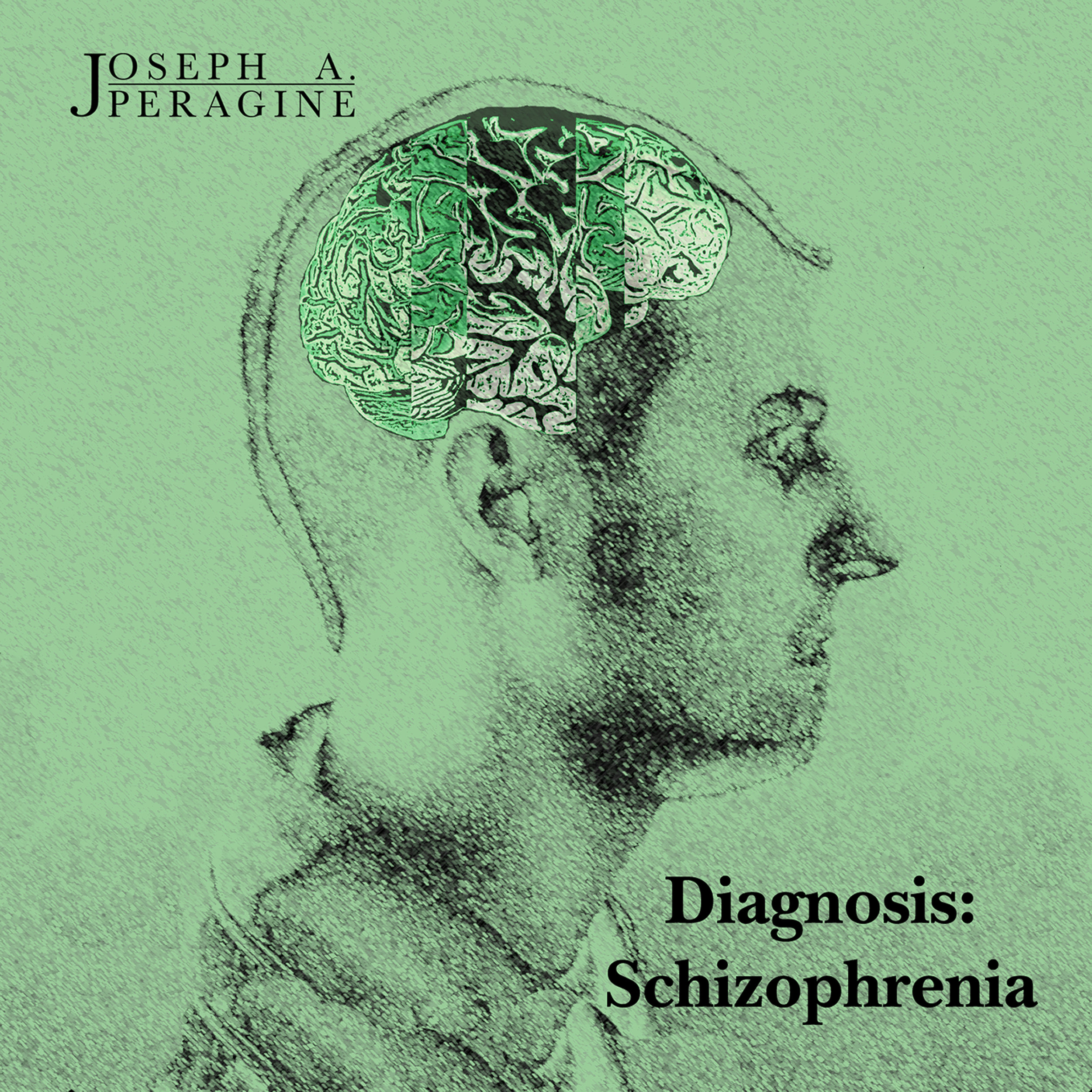 Diagnosis: Schizophrenia 