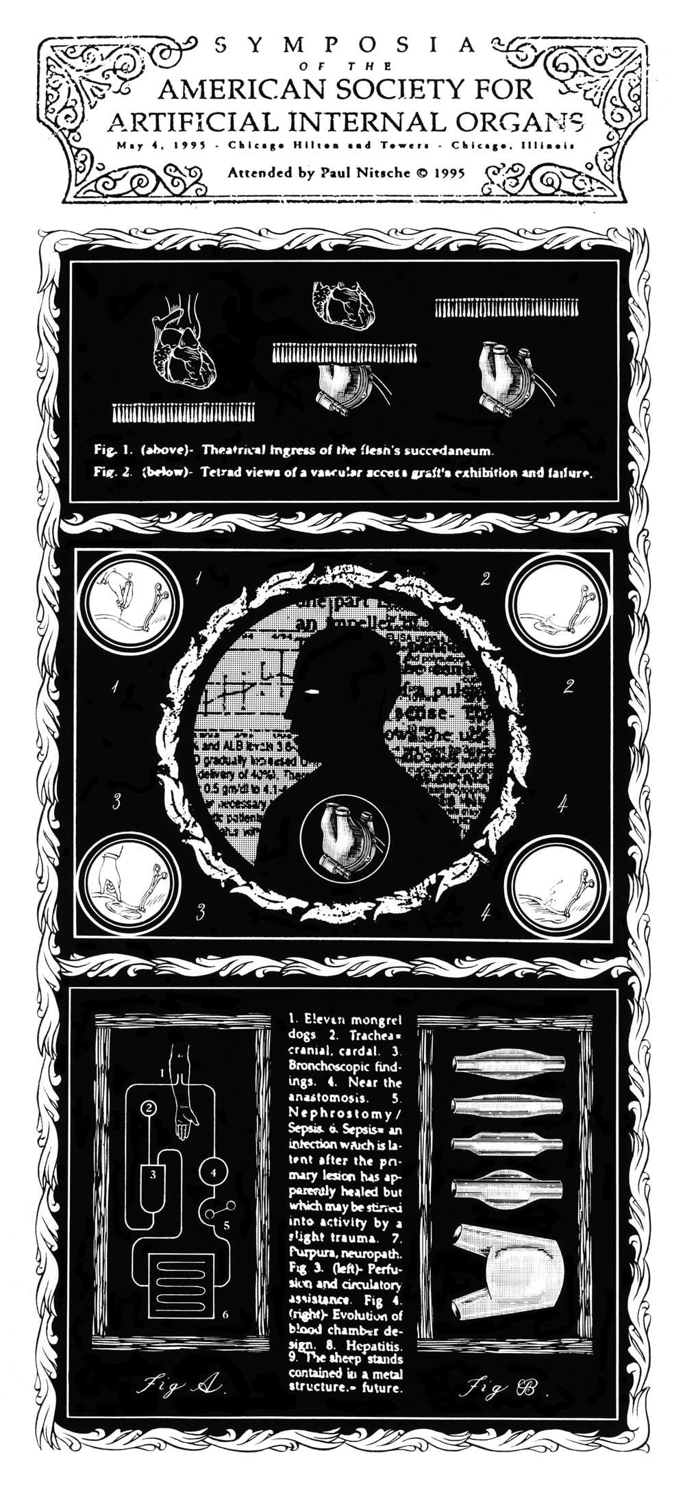   Symposia of the American Society for Artificial Internal Organs . 1 Page. 1995. Pen and ink, Scratch board. Published by  New City  Weekly Newspaper. 