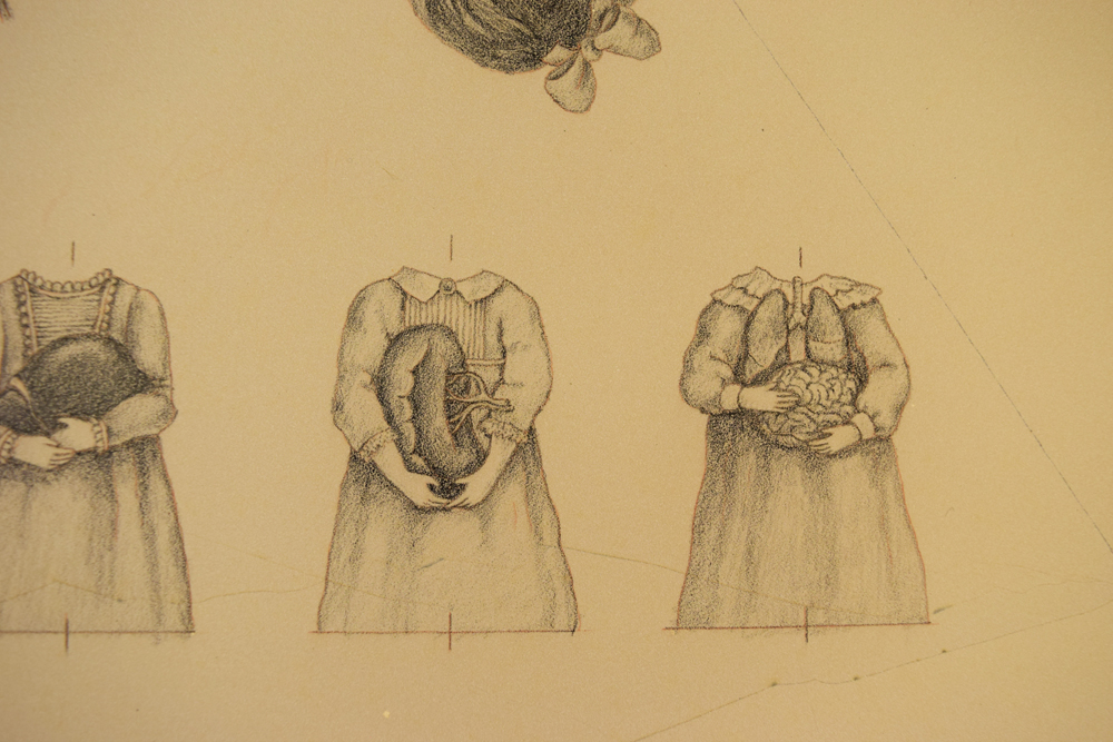  The lithography stone drawings for the dresses cooresponding to Yellow Bile (spleen) and Phlegm (brain and lungs). 
