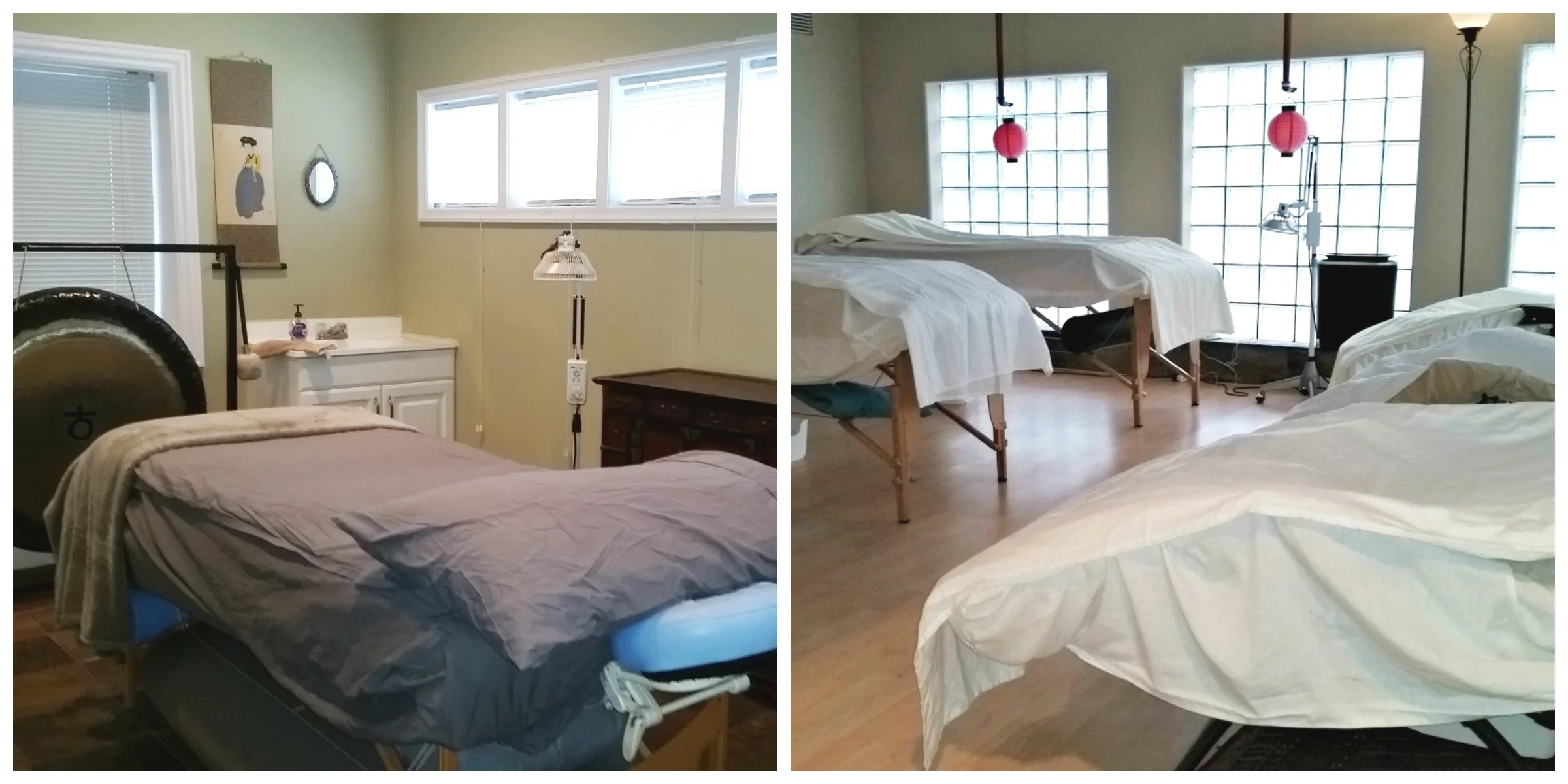 FAQ: Private vs. Community Acupuncture