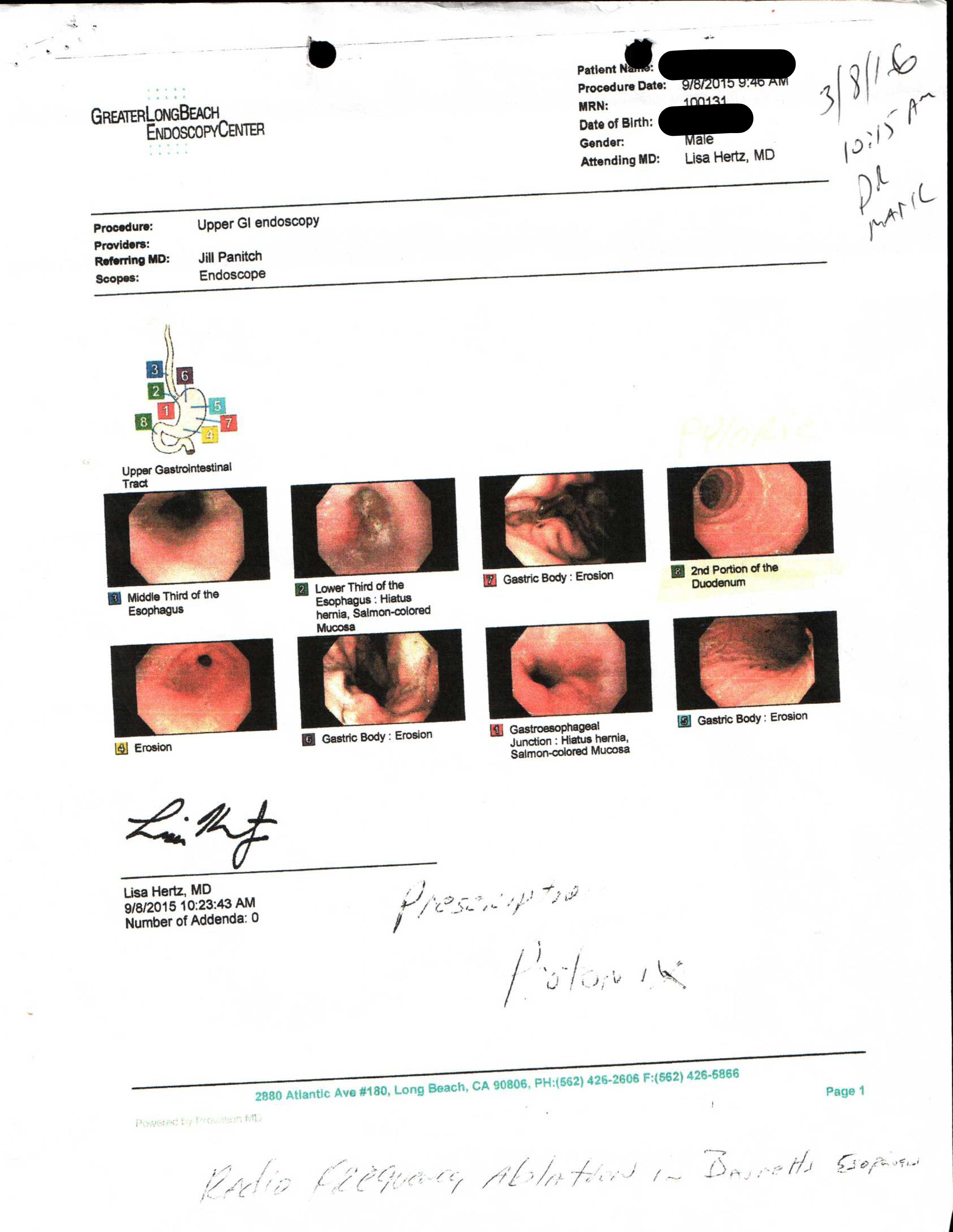 SEVERE GASTRITIS EROSIVE ACUPUNCTURE FOR DIGESTIVE DISORDER BEFORE