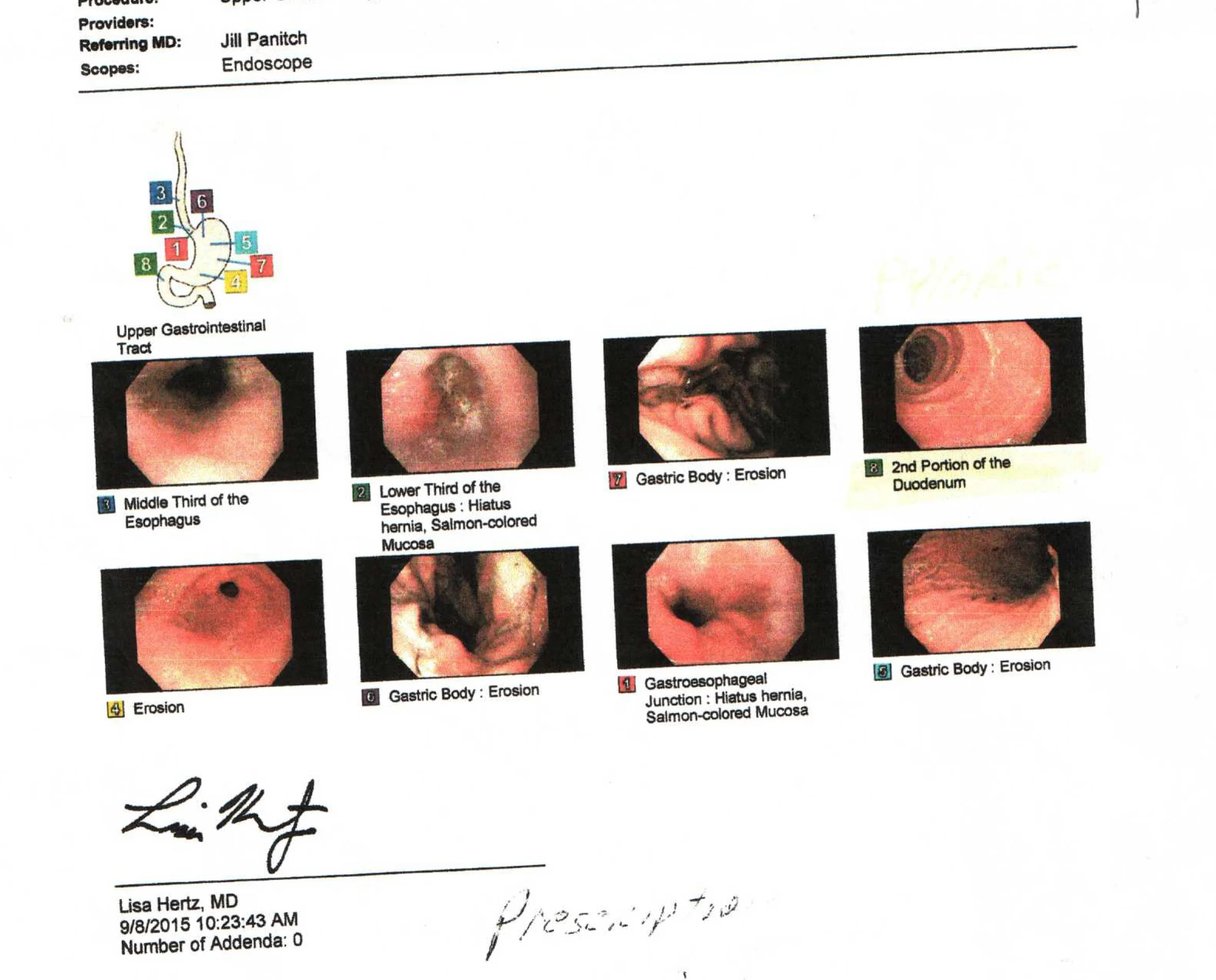 SEVERE GASTRITIS EROSIVE | ACUPUNCTURE FOR DIGESTIVE DISORDER | BEFORE AND AFTER COMPARISON | LAB RESULTS BACTERIAL OVERGROWTH SMALL INTESTINES
