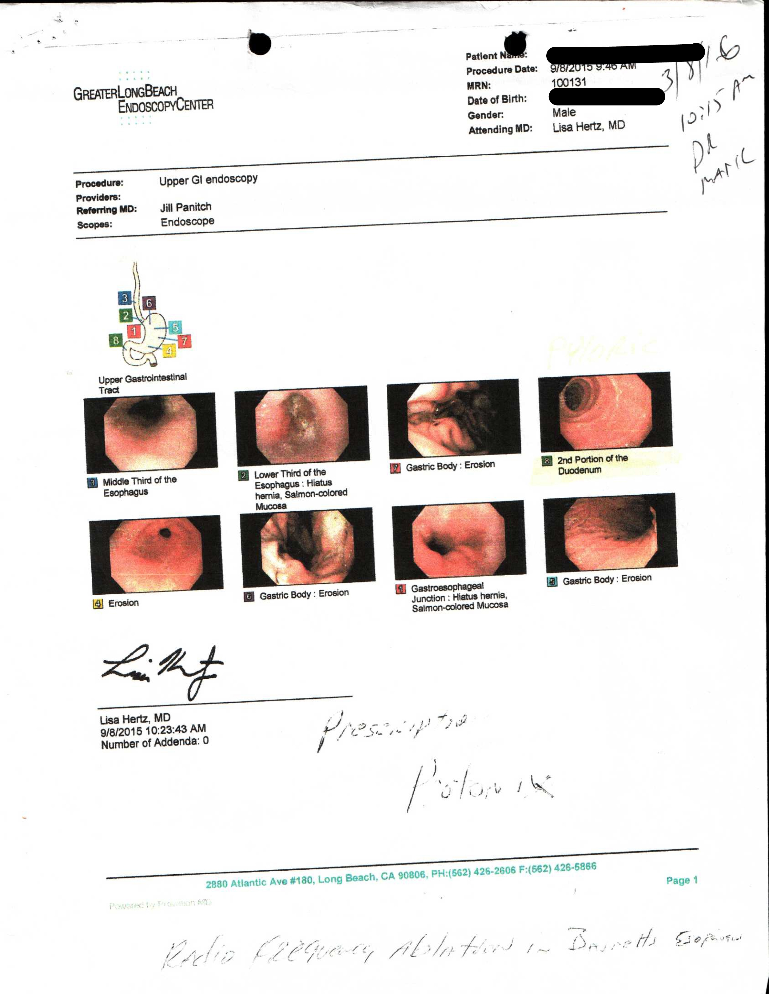 BEFORE COMING TO OUR CLINIC | UPPER GI ENDOSCOPY 9/8/2015 BY ATTENDING MD