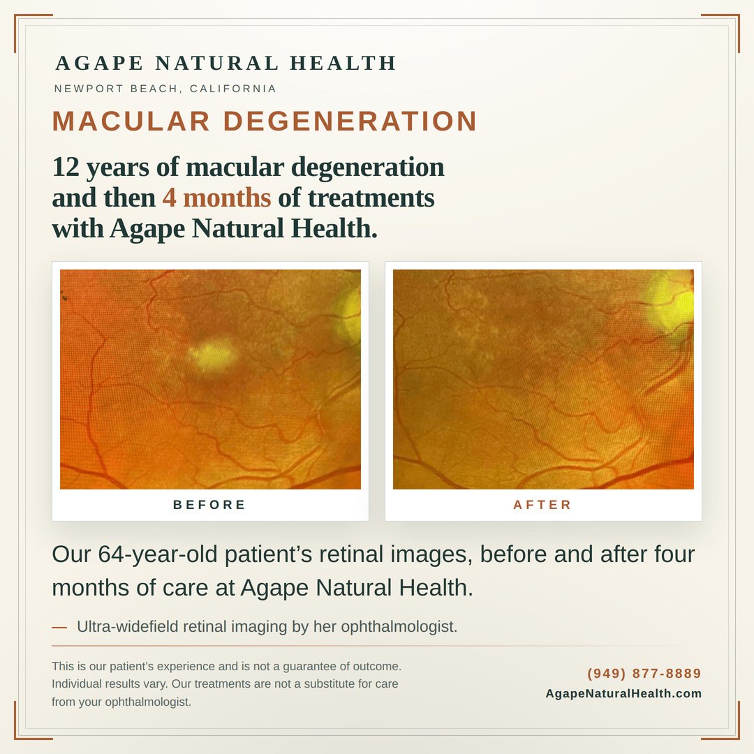Agape Natural Health Macular Degeneration Before After Photos.jpg