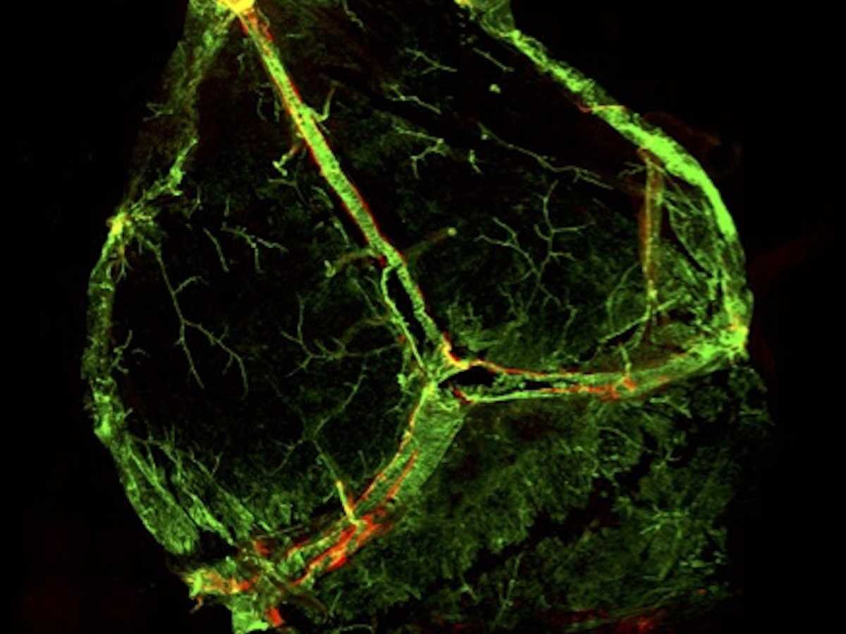 Newly discovered brain lymphatic vessels are shown in red, almost invisible beside the blood vessels (in green). Image courtesy of University of Virginia.