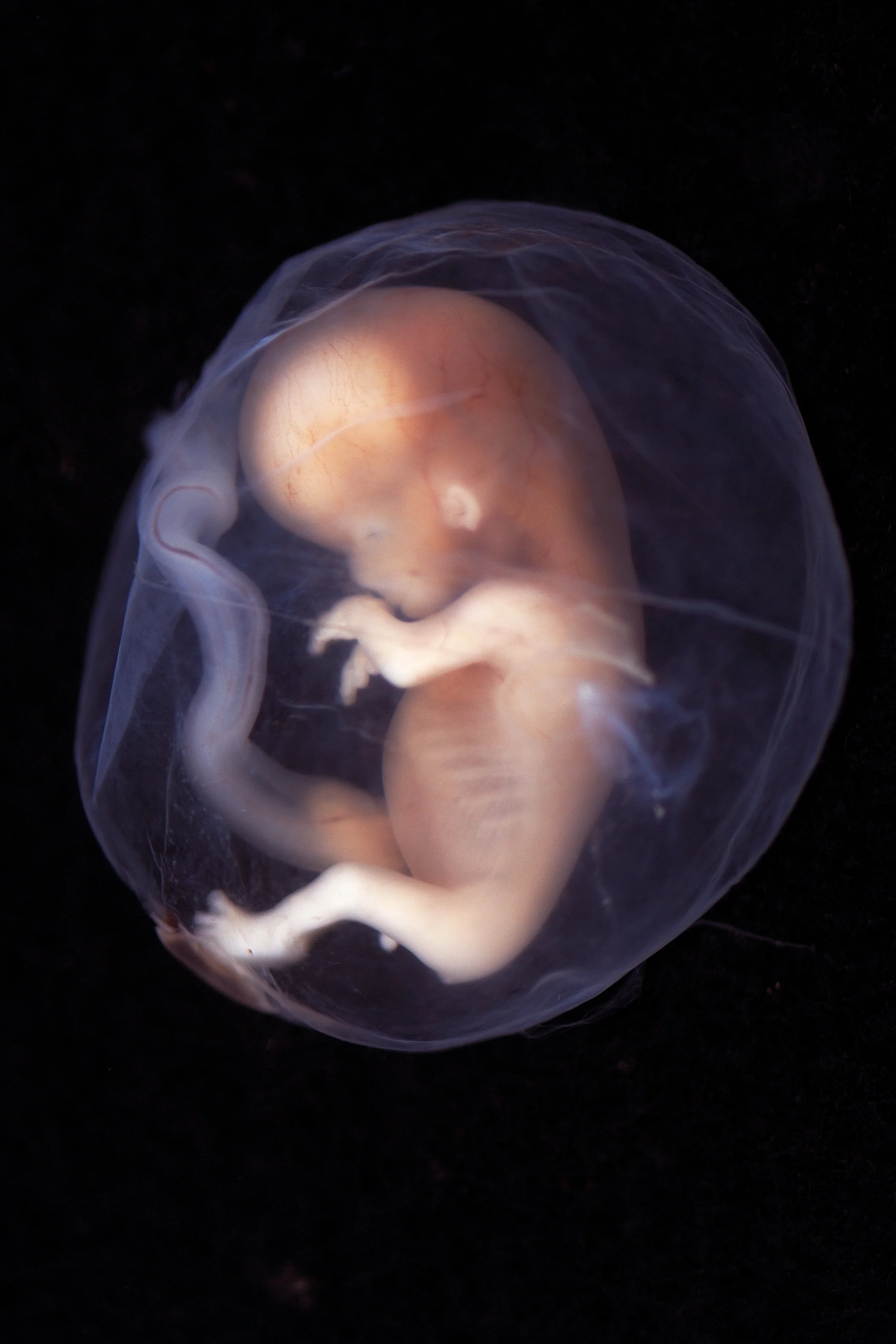 Image Credit: “ Embryo week 9-10 ” by Lunar Caustic is licensed under CC by 2.0