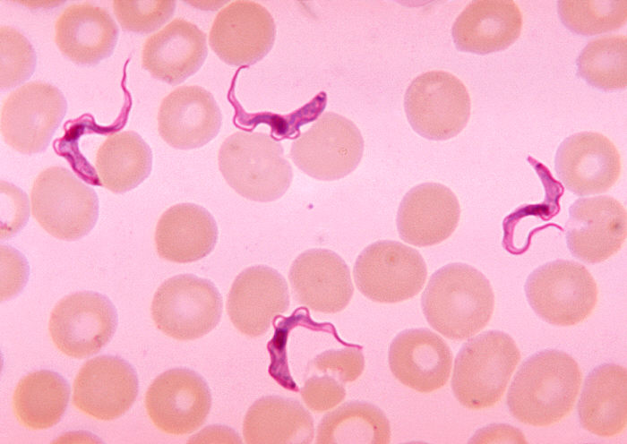 African trypanosomes, a brain-infecting parasite, surrounded by red blood cells. Image Credit: Centers for Disease Control and Prevention