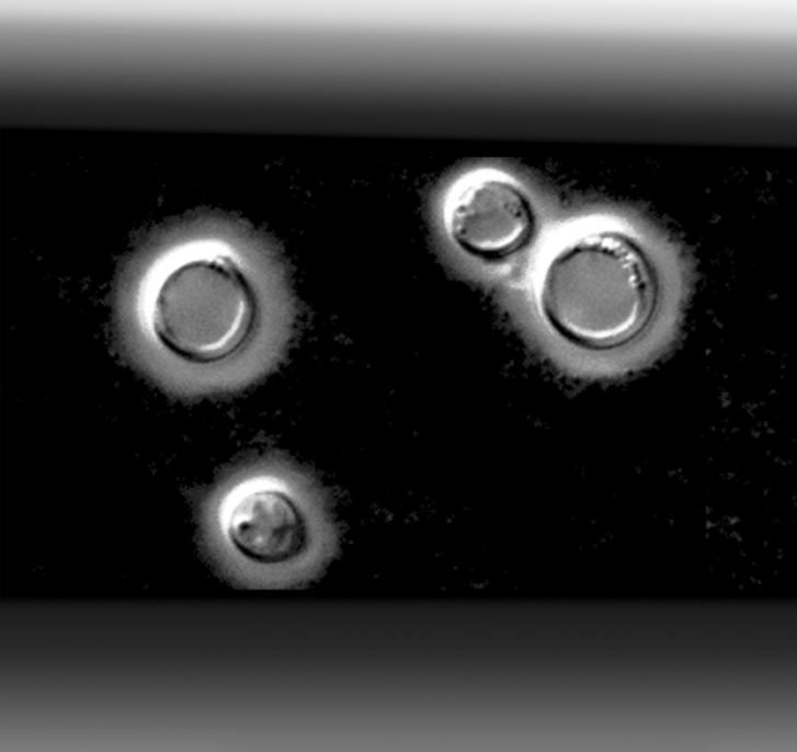 C. neoformans as single cells. Image credit: Gross L (2006) Iron Regulation and an Opportunistic AIDS-Related Fungal Infection. PLoS Biol 4(12): e427. doi:10.1371/journal.pbio.0040427.