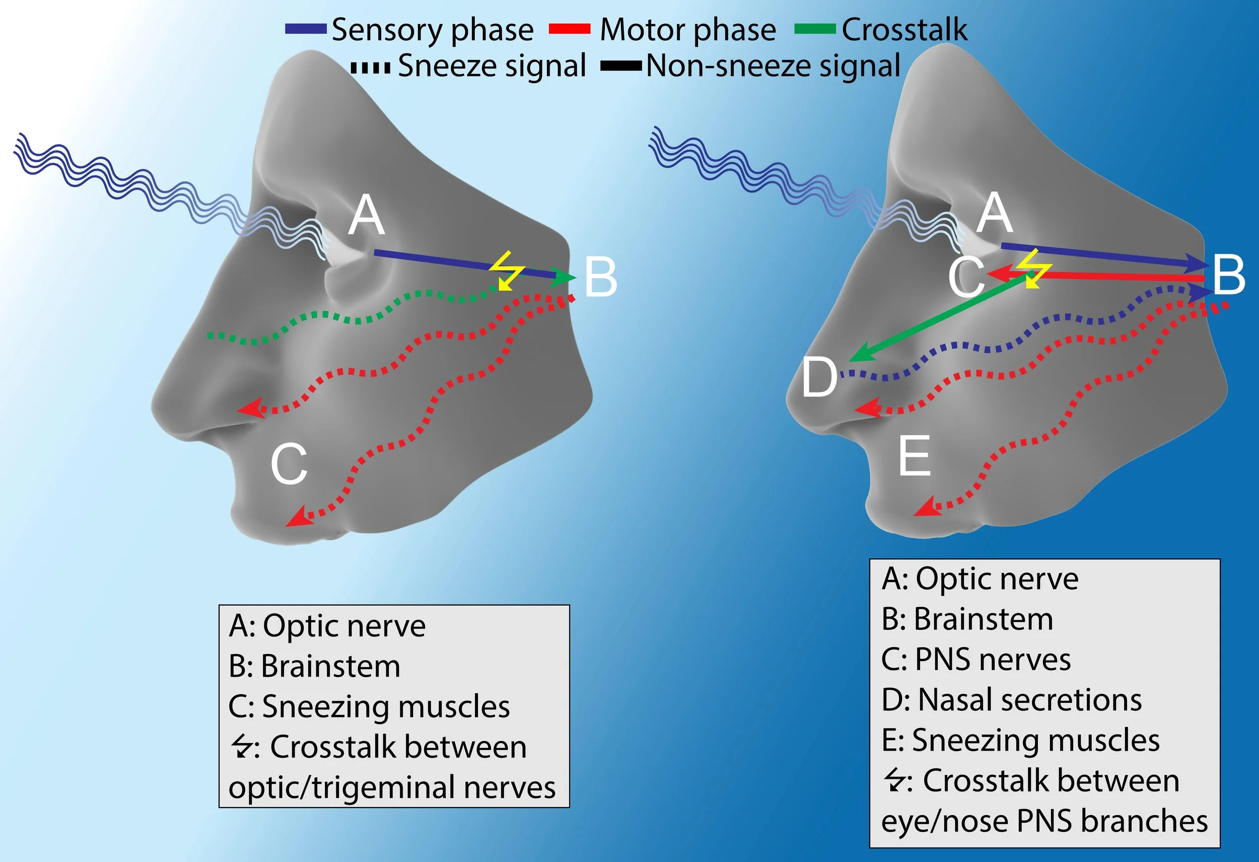 Figure 2: Potential mechanisms of ACHOO : Theory 1: The optic nerve (A) senses the sudden bright light and unintentionally activates the nearby trigeminal nerve. As a result, the brainstem (B) thinks there is nasal irritation and proceeds to activate the sneezing muscles (C). Theory 2: The optic nerve (A) senses the sudden bright light and the brainstem (B) stimulates the PNS (C) to constrict the pupils. Some of this stimulation is unintentionally sent to the nose (D), causing nasal secretions. These secretions act as nasal irritants and activate the sneezing reflex. Image Credit: Alex Sercel with the “face” image licensed under CC BY-NC-SA 4.0 .