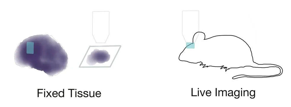 Dissecting Two Photon Microscopy Signal To Noise