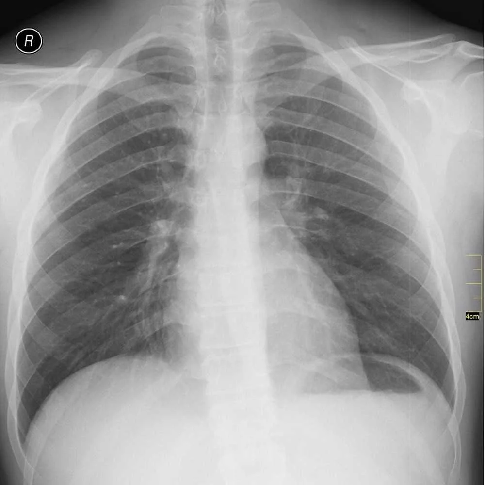 Radiology Interest Group