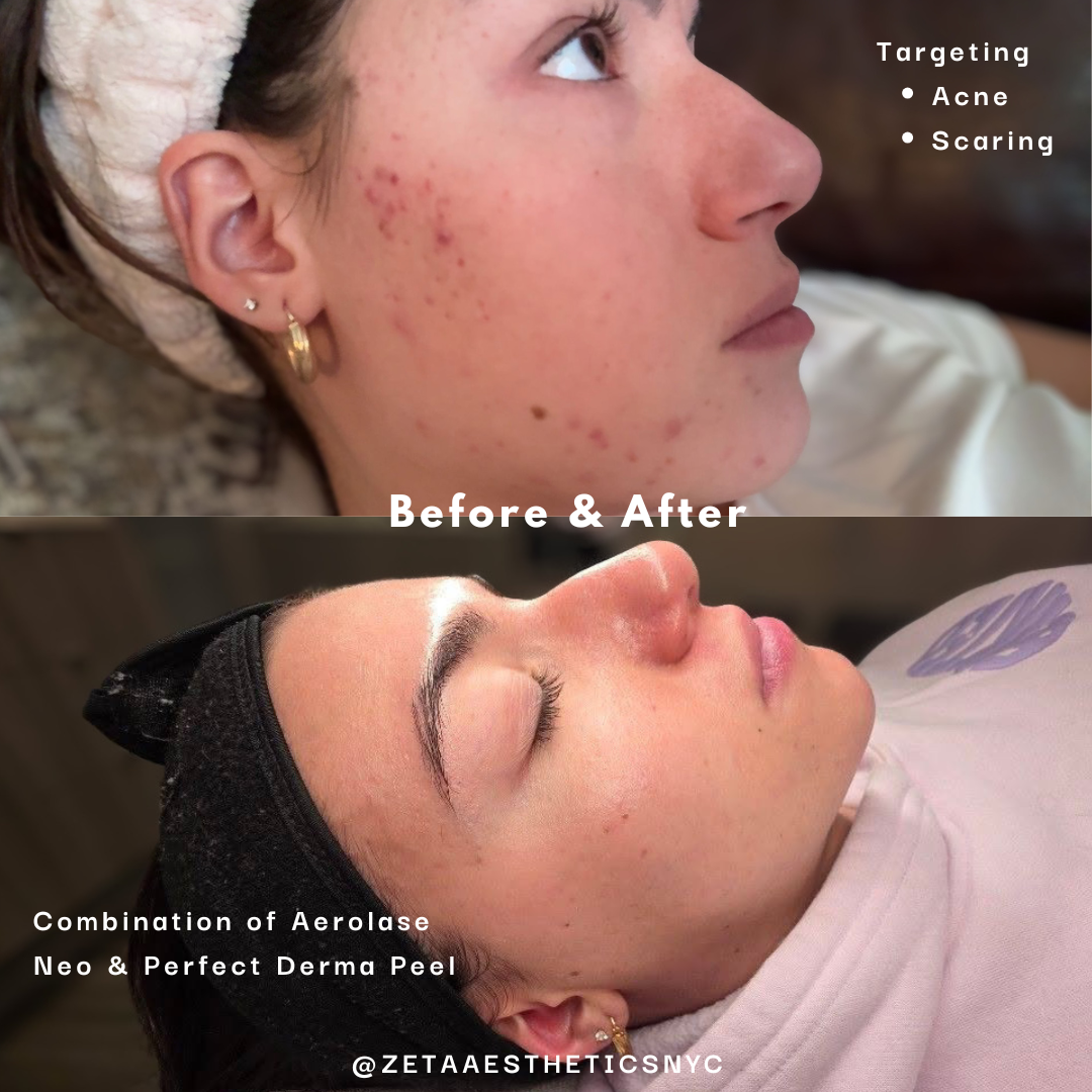 skin Journey pic 2.png