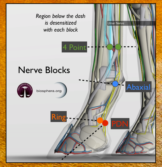 Nerve Blocks.png