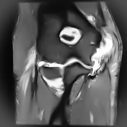 January 19, 2016 - 01h.11m.20s - elbow.jpeg