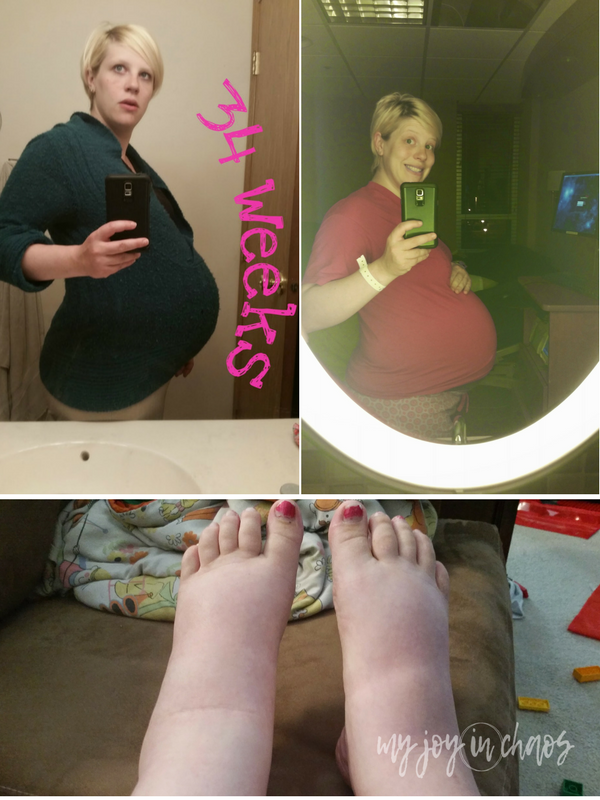  pre-eclampsia twin pregnancy 