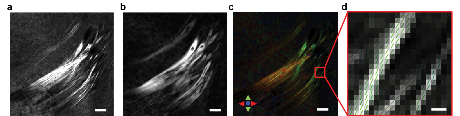 a, Raw CLARITY image, showing outgoing mPFC projections (EYFP). b, Image intensity gradient amplitude, computed by convolving the 3-dimensional CLARITY image volume with three 3-dimensional 1st order derivative of Gaussian functions, c, Color-coded principal fiber orientations (A-P: red; D-V, green; L-M, blue), estimated as the tertiary eigenvectors of computed structure tensors. For better visualization, the color brightness was weighted by the raw CLARITY image intensity. Scale bars in a-c: 100 µm. d, A zoomed-in region of (c) showing the principal fiber orientations as color-coded vector fields overlaid on raw CLARITY image. The vectors are color-coded for their orientation. Scale bar: 6µm.