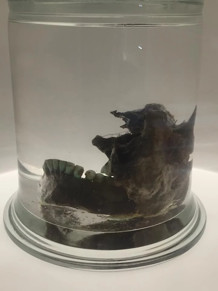 Preserved cheek from a woman who immigrated to Iceland and lived there over 1,000 years ago. Shout out to the copper brooches!