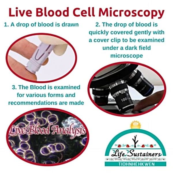 Live Blood Cell Microscopy - what it entails