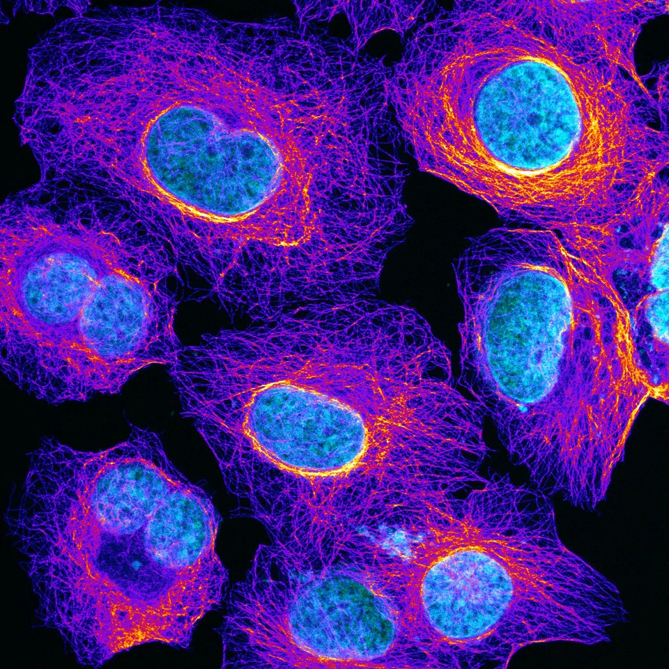 1st_Emily Summerbell - fire_tubulin.jpeg