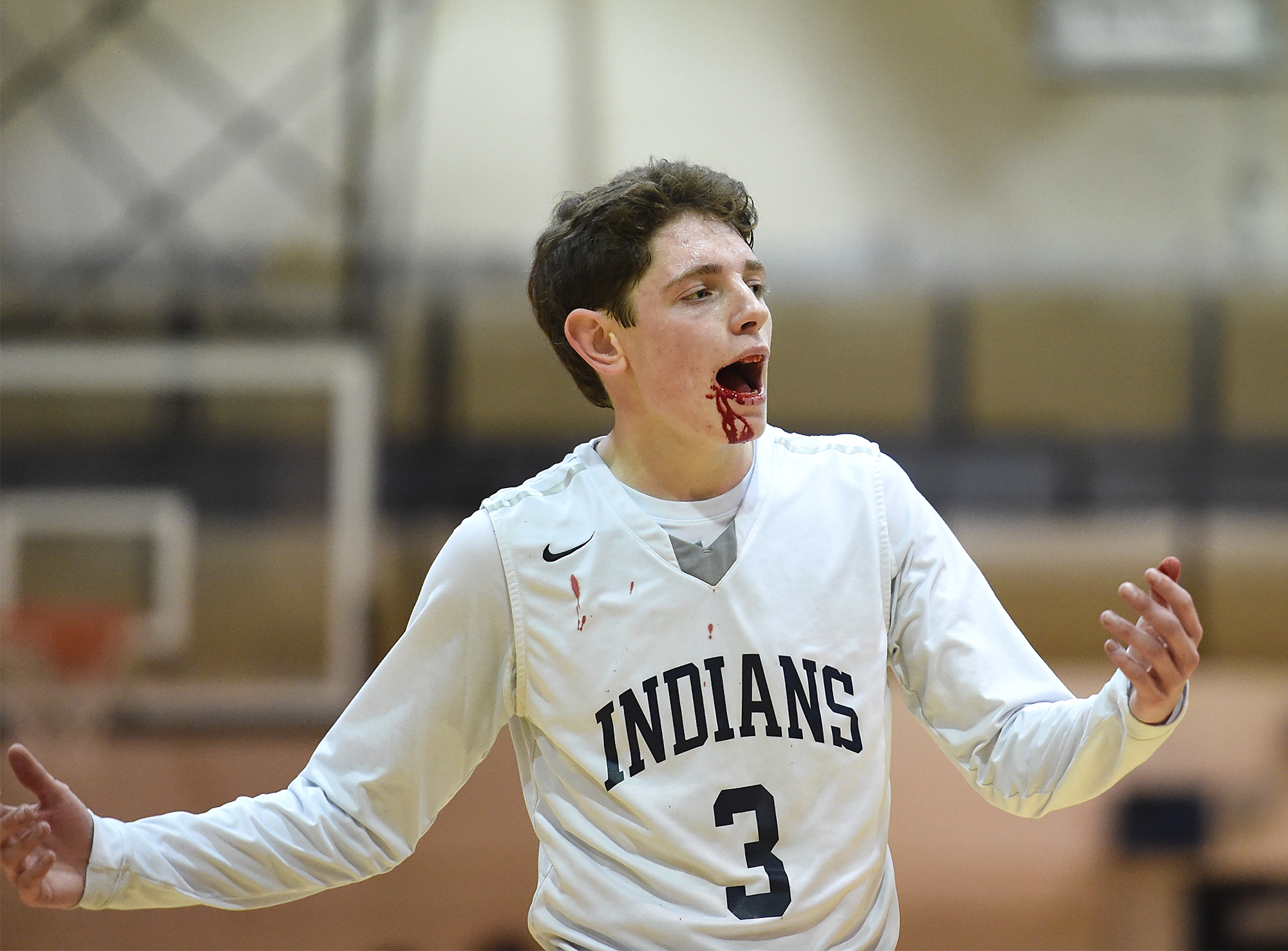  Council Rock North's Riley Thompson (3) puts his hands in the air after getting an offensive foul call against him that left him bleeding during their game in the opening round of the Athletes Helping Athletes Classic at Council Rock North. Central 