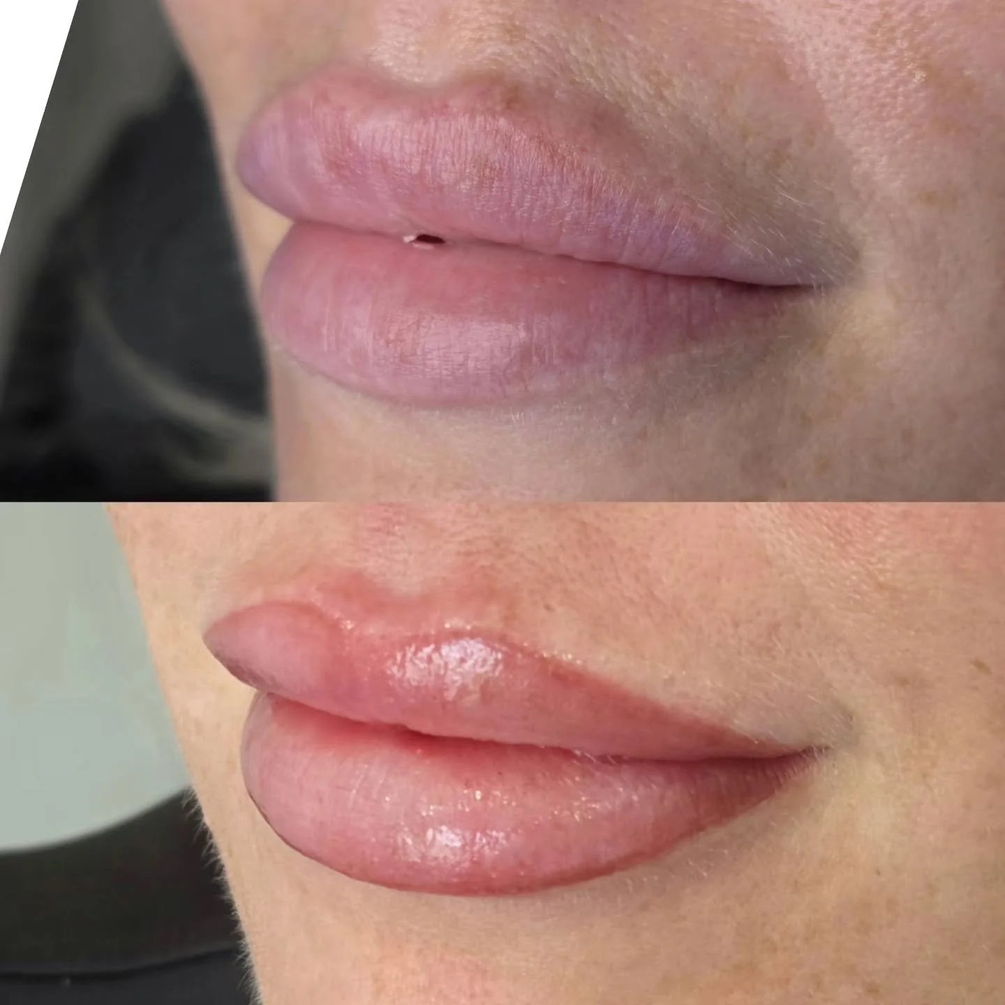 I AM OBSESSED 👄

The softest nudey pink for my client wanting a little more definition to her lips.

#lipblush #liptattoo #spmu #permanentmakeup #wynyard
