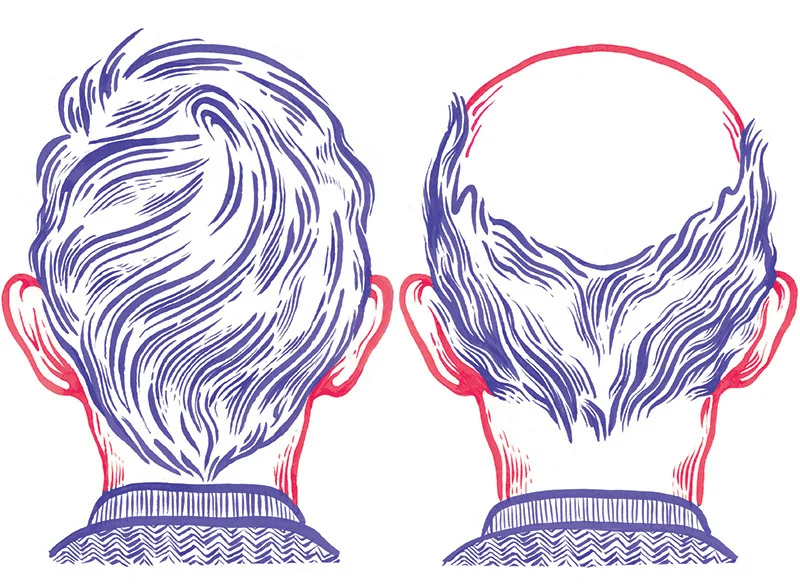 HairLoss_Artwork_web_01_1_800.jpg