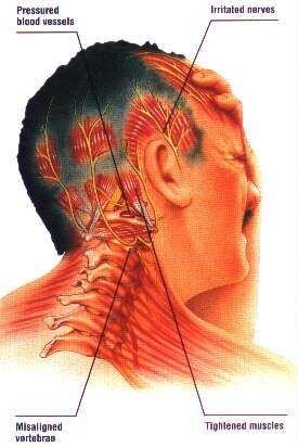 Headaches and Neck Pain Portland & Winchester