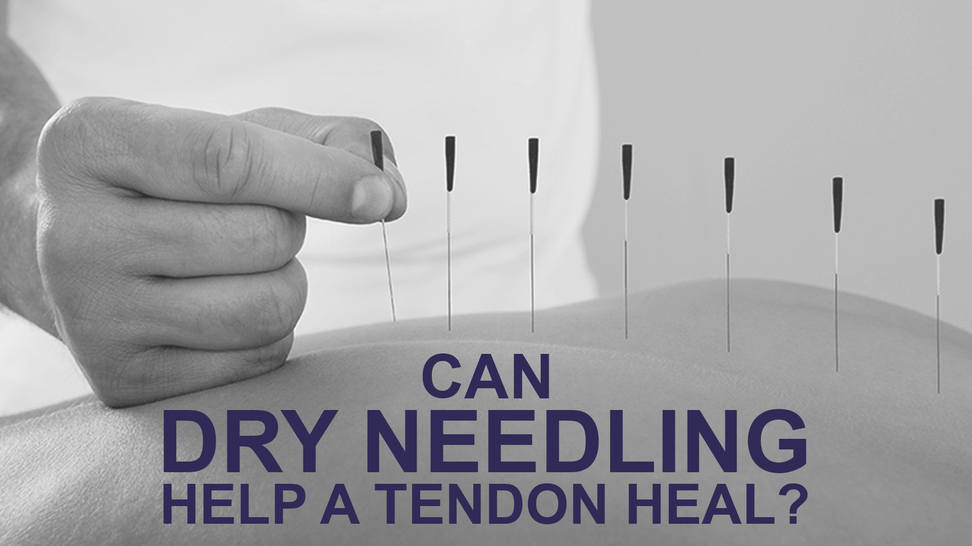 Can dry needling help a tendon heal?