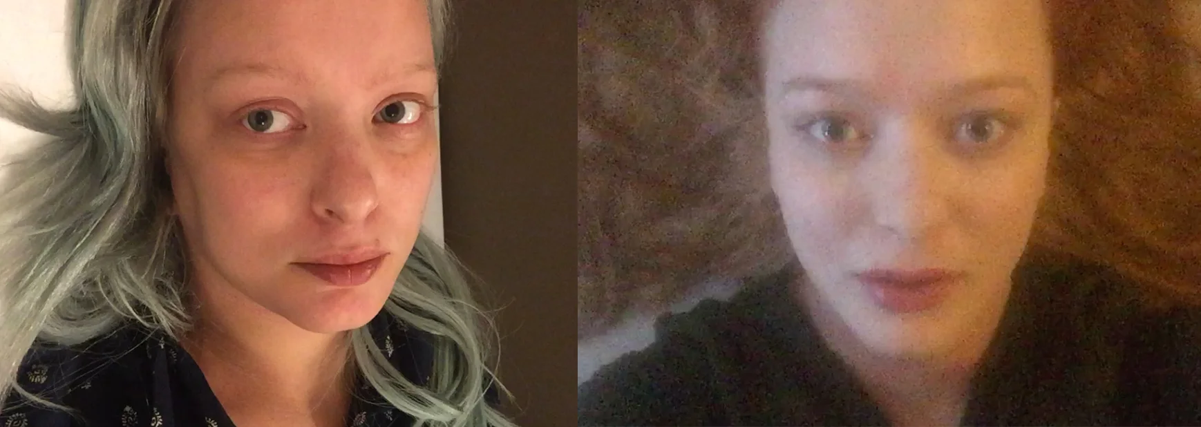 Stills taken from my video diaries. Left: November 2016, right: March 2017.