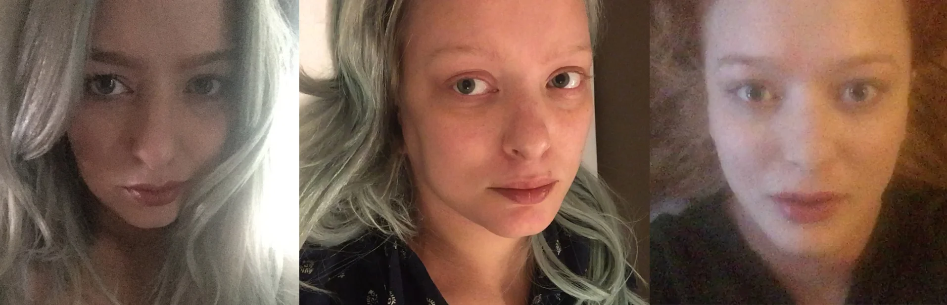 12 months in 3 images. The first image was from mid 2016, before I was hospitalised for depression, when I was doing fine. The second image was taken around the end of 2016, while I was hospitalised. You can see in my face that I lost weight, and wasn't doing well. The third image was during the end of my hospitalisation, mid 2017; I had gained 20 kilos due to my medication at this point (you can clearly see it in my face).