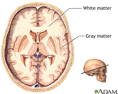 The brain: white matter and grey/gray matter. Source: A.D.A.M Education