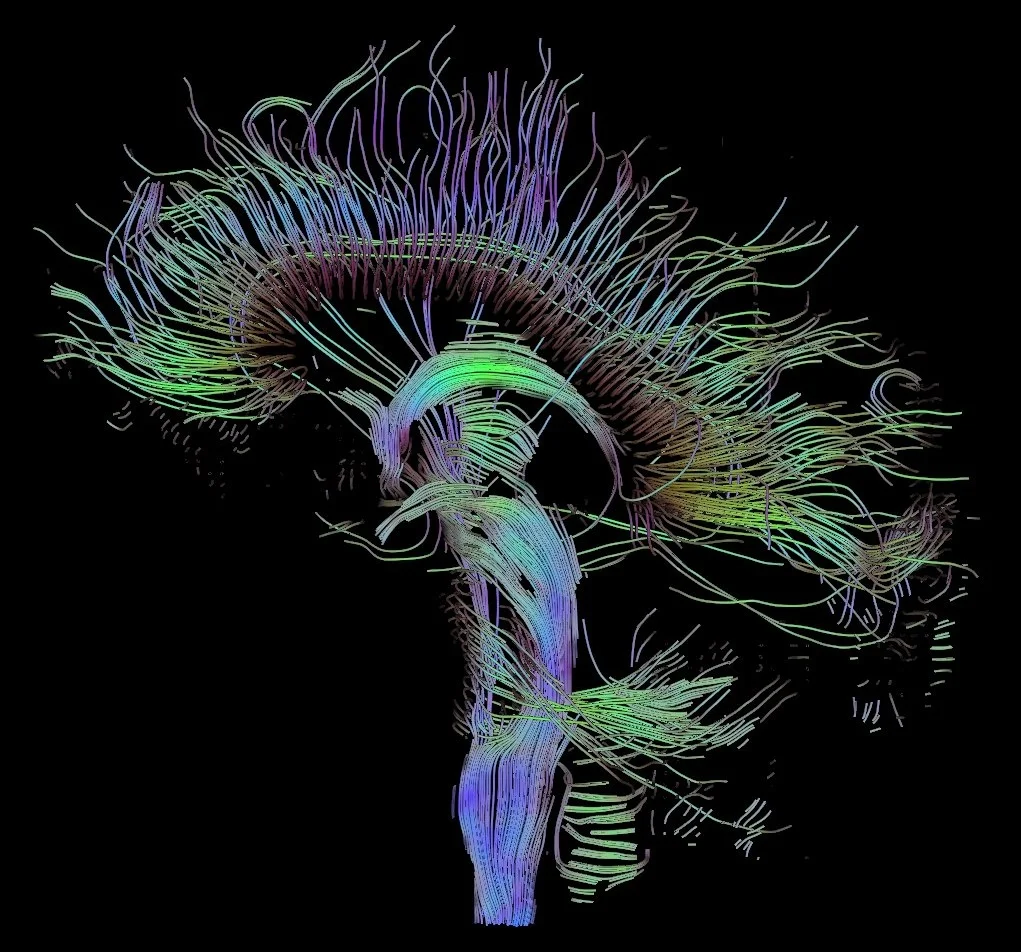 An image of neural pathways in the brain, taken using Diffusion Tensor Imaging (DTI). Source: Thomas Schultz