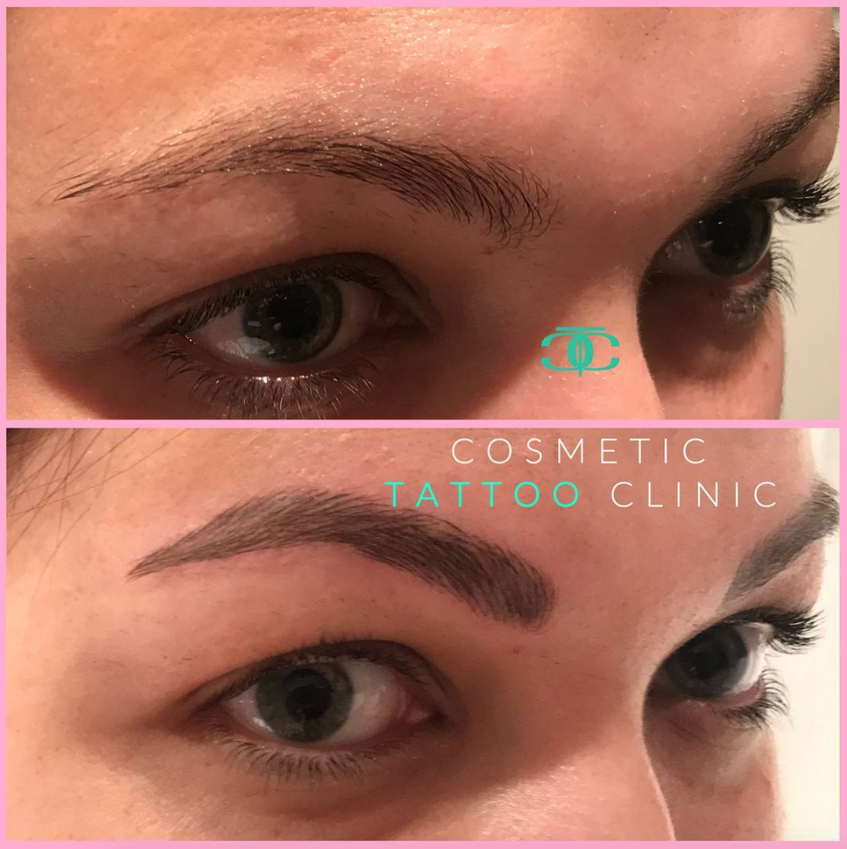 Before & After
