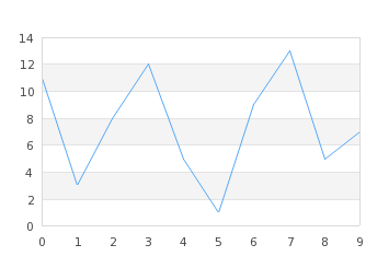 Your revenue should NOT look like this. The line should be as flat and upward sloping as possible