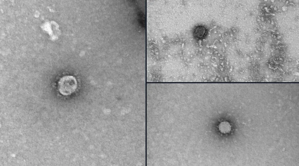 Российские ученые расшифровали геном и сфотографировали коронавирус. ФОТО