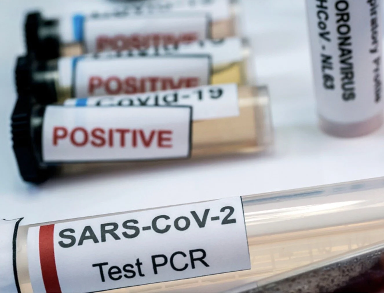 Врачи назвали, что формирует иммунитет к COVID-19, а что его рушит, грозя человеку смертью