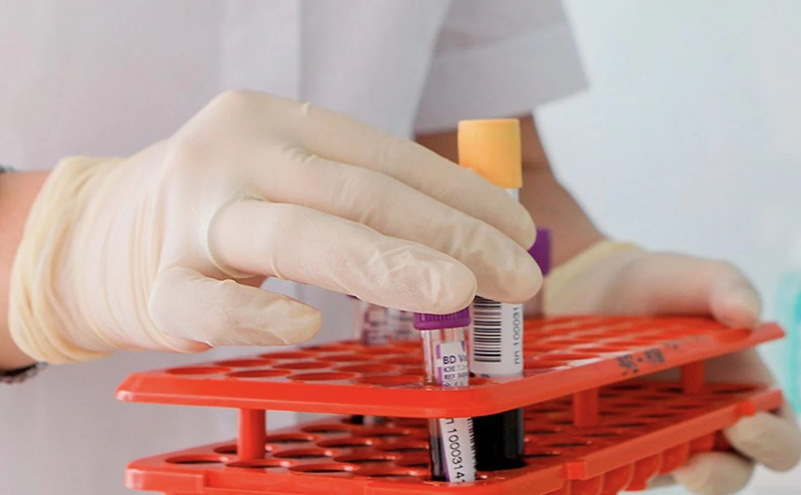 Число заразившихся коронавирусом в России превысило 262 тыс. человек