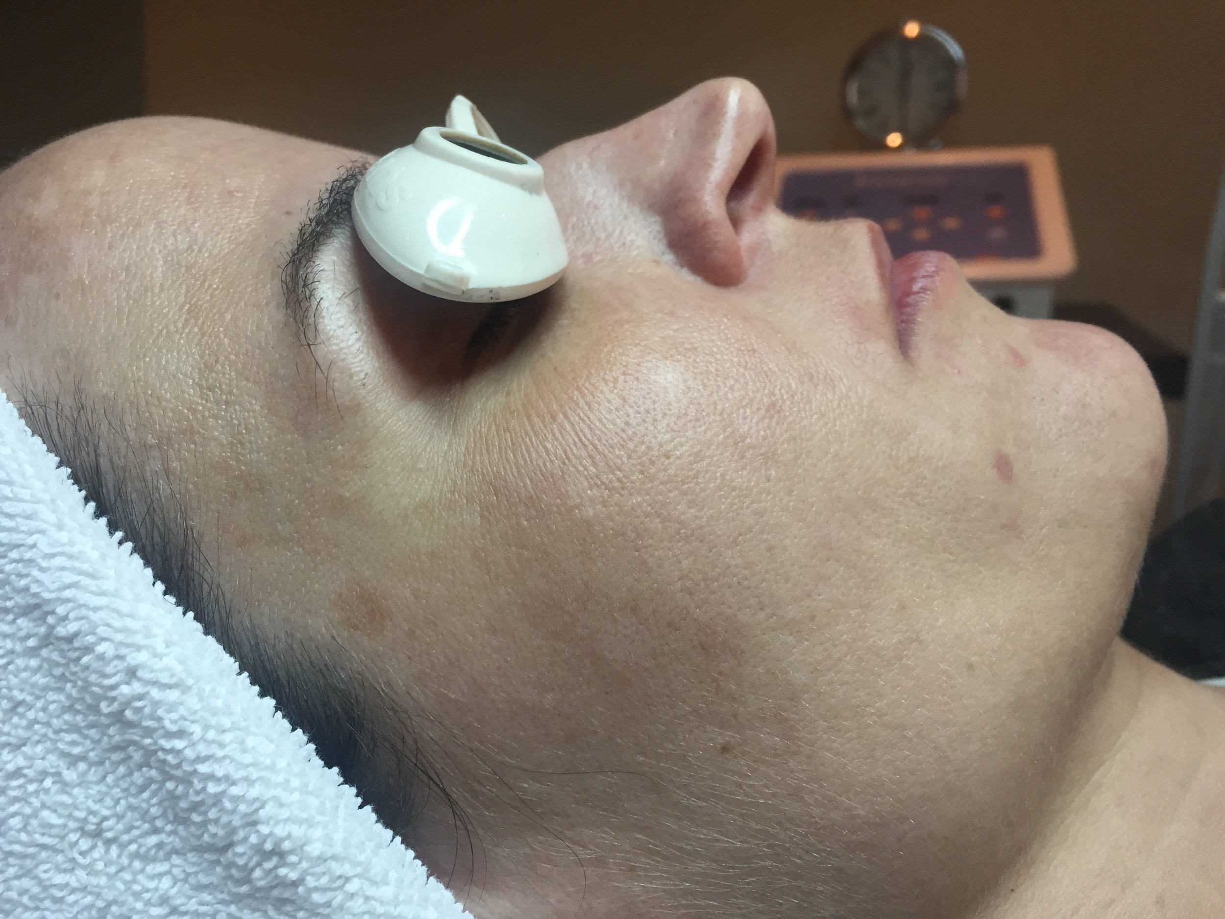 holistic facial rejuvenation