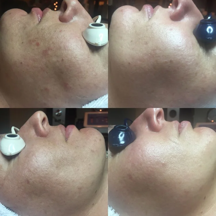 Treatments for pigmentation and aging.jpeg