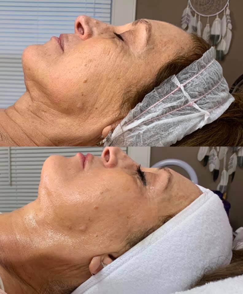 3-facials-sessions.jpg